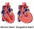 Congestive Heart - Living With Heart Failure How Congestive Heart Failure Impacts Your Life