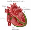 Congestive Heart - congestive heart articles